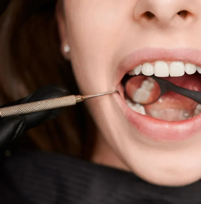 Dental Extraction